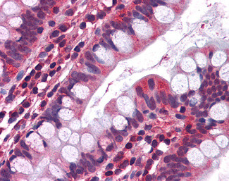 HTR3A Antibody in Immunohistochemistry (Paraffin) (IHC (P))