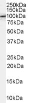 Fe65 Antibody in Western Blot (WB)
