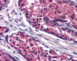 SNX26 Antibody in Immunohistochemistry (Paraffin) (IHC (P))