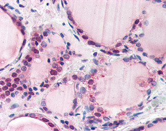 FBXL3 Antibody in Immunohistochemistry (Paraffin) (IHC (P))