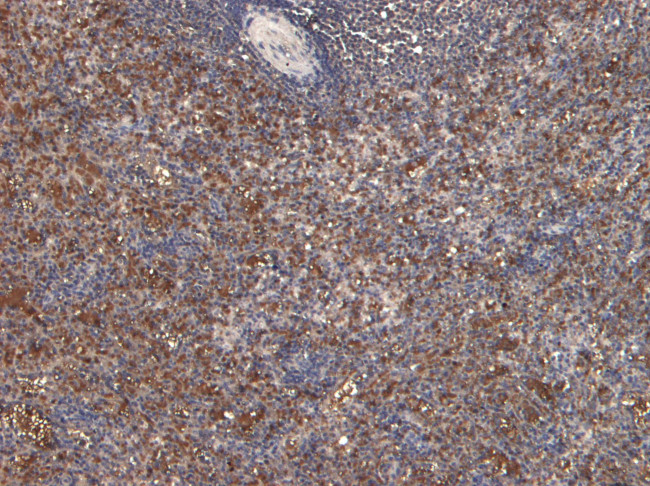 Septin 1 Antibody in Immunohistochemistry (Paraffin) (IHC (P))