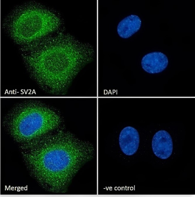 SV2A Antibody in Immunocytochemistry (ICC/IF)