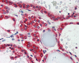 LPIN3 Antibody in Immunohistochemistry (Paraffin) (IHC (P))