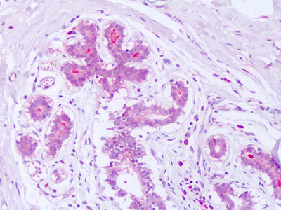 Syntenin 1 Antibody in Immunohistochemistry (Paraffin) (IHC (P))