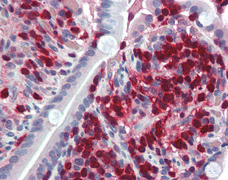 S100A4 Antibody in Immunohistochemistry (Paraffin) (IHC (P))