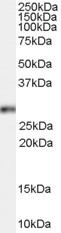 HOXB13 Antibody in Western Blot (WB)