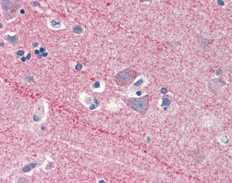 ICAM-5 Precursor Antibody in Immunohistochemistry (Paraffin) (IHC (P))
