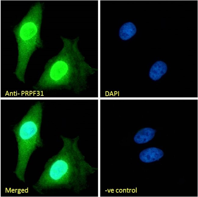 PRPF31 Antibody in Immunocytochemistry (ICC/IF)