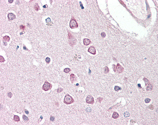 HAP1 Antibody in Immunohistochemistry (Paraffin) (IHC (P))