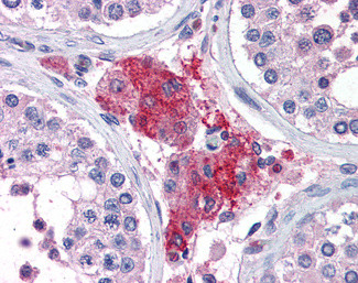 ACYP1 Antibody in Immunohistochemistry (Paraffin) (IHC (P))