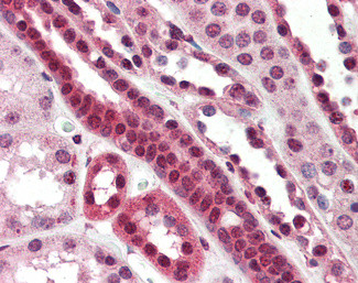 TCF3 Antibody in Immunohistochemistry (Paraffin) (IHC (P))