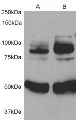 APPL1 Antibody in Western Blot (WB)