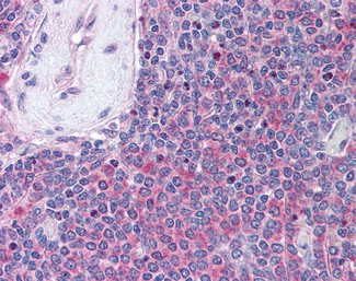UBASH3A Antibody in Immunohistochemistry (Paraffin) (IHC (P))