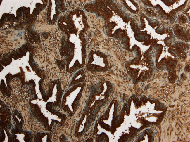 Kallikrein 2 Antibody in Immunohistochemistry (Paraffin) (IHC (P))