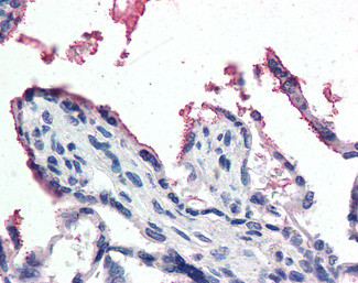 Gpx3 Antibody in Immunohistochemistry (Paraffin) (IHC (P))