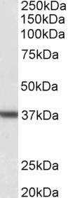 Arginase 1 Antibody in Western Blot (WB)