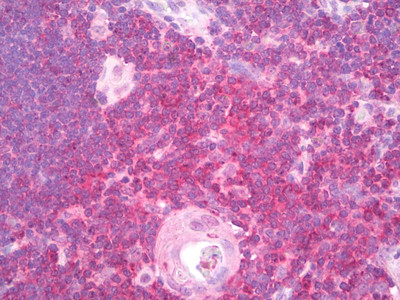 SHP-1 Antibody in Immunohistochemistry (Paraffin) (IHC (P))