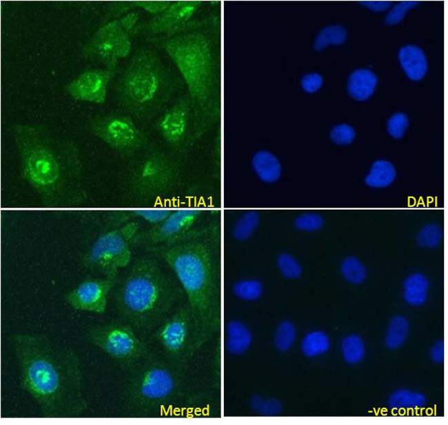 TIA-1 Antibody in Immunocytochemistry (ICC/IF)