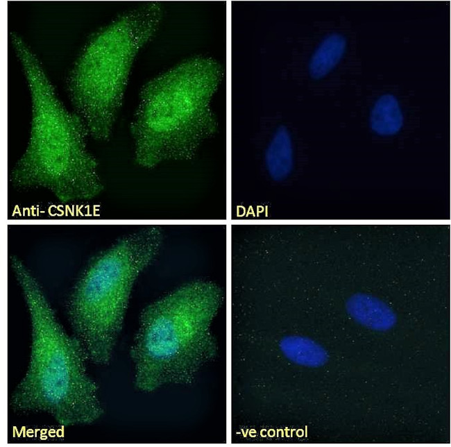 CK1 epsilon Antibody in Immunocytochemistry (ICC/IF)