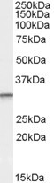 PSME1 Antibody in Western Blot (WB)
