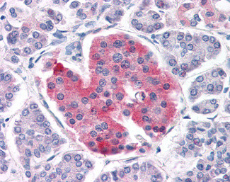 Kir6.2 (KCNJ11) Antibody in Immunohistochemistry (Paraffin) (IHC (P))