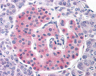 Kir6.2 (KCNJ11) Antibody in Immunohistochemistry (Paraffin) (IHC (P))