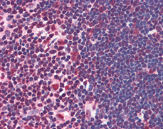 ILF2 Antibody in Immunohistochemistry (Paraffin) (IHC (P))