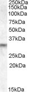 PRUNE2 Antibody in Western Blot (WB)