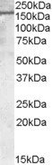 PODXL Antibody in Western Blot (WB)