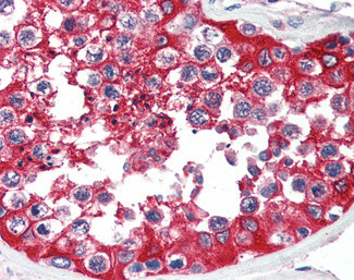 G6PD Antibody in Immunohistochemistry (Paraffin) (IHC (P))