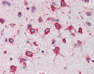 RPL8 Antibody in Immunohistochemistry (Paraffin) (IHC (P))