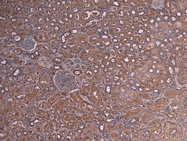 Myb Antibody in Immunohistochemistry (Paraffin) (IHC (P))