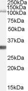 IDE Antibody in Western Blot (WB)