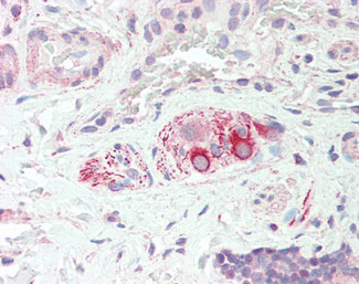 Neurturin Antibody in Immunohistochemistry (Paraffin) (IHC (P))