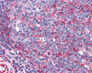 THRA Antibody in Immunohistochemistry (Paraffin) (IHC (P))