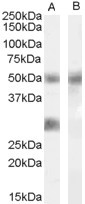 IGFBP3 Antibody in Western Blot (WB)