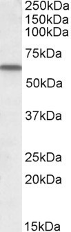 GC Antibody in Western Blot (WB)