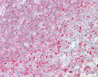 TPD52 Antibody in Immunohistochemistry (Paraffin) (IHC (P))