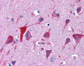 TPD52L2 Antibody in Immunohistochemistry (Paraffin) (IHC (P))