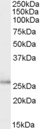 TPD52L1 Antibody in Western Blot (WB)
