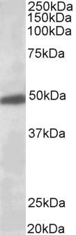 Kir3.2 (KCNJ6) Antibody in Western Blot (WB)