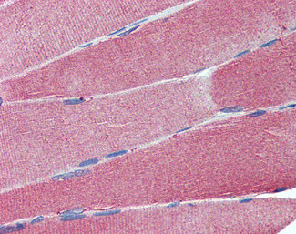 CADM4 Antibody in Immunohistochemistry (Paraffin) (IHC (P))
