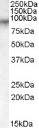 Factor XIII A Antibody in Western Blot (WB)