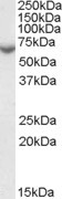 STS Antibody in Western Blot (WB)