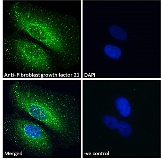 FGF21 Antibody in Immunocytochemistry (ICC/IF)