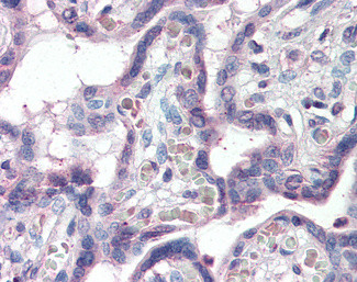 KCC1 Antibody in Immunohistochemistry (Paraffin) (IHC (P))