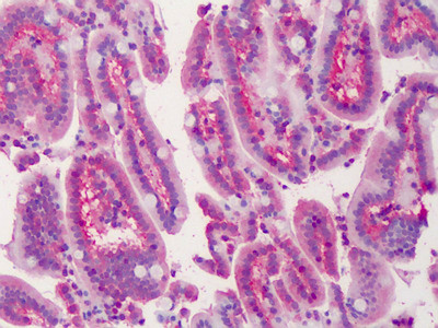LASP1 Antibody in Immunohistochemistry (Paraffin) (IHC (P))