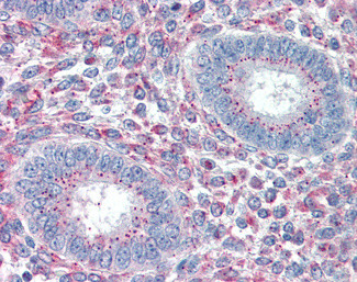 PRRX1 Antibody in Immunohistochemistry (Paraffin) (IHC (P))