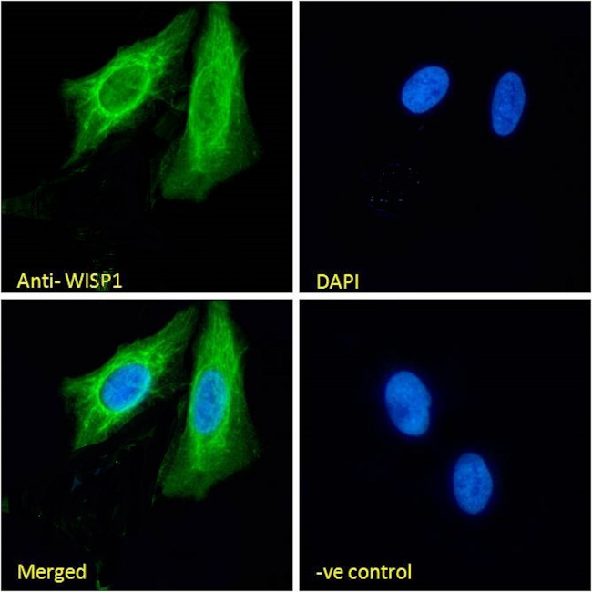 WISP1 Antibody in Immunocytochemistry (ICC/IF)