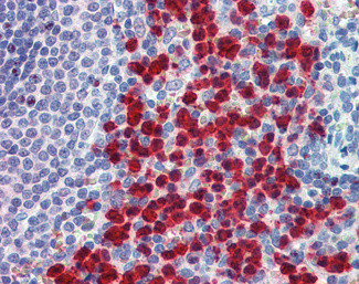 CADM4 Antibody in Immunohistochemistry (Paraffin) (IHC (P))
